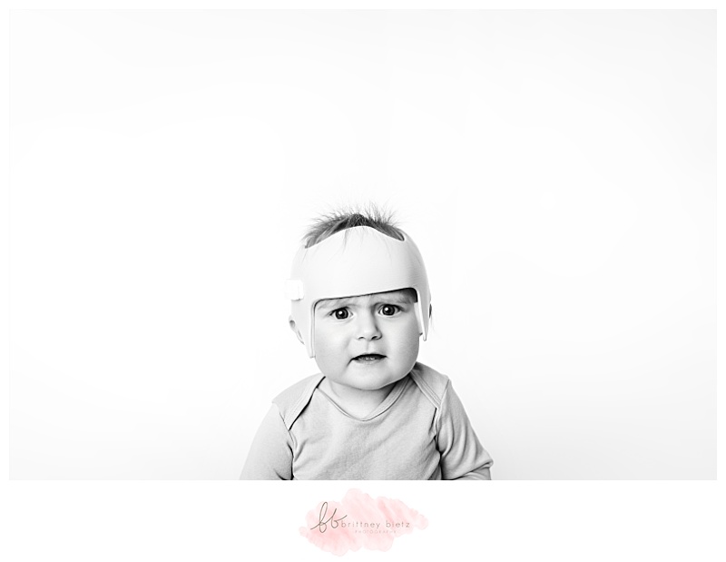 black and white portrait of a baby looking at the camera confused wearing head-shaping helmet