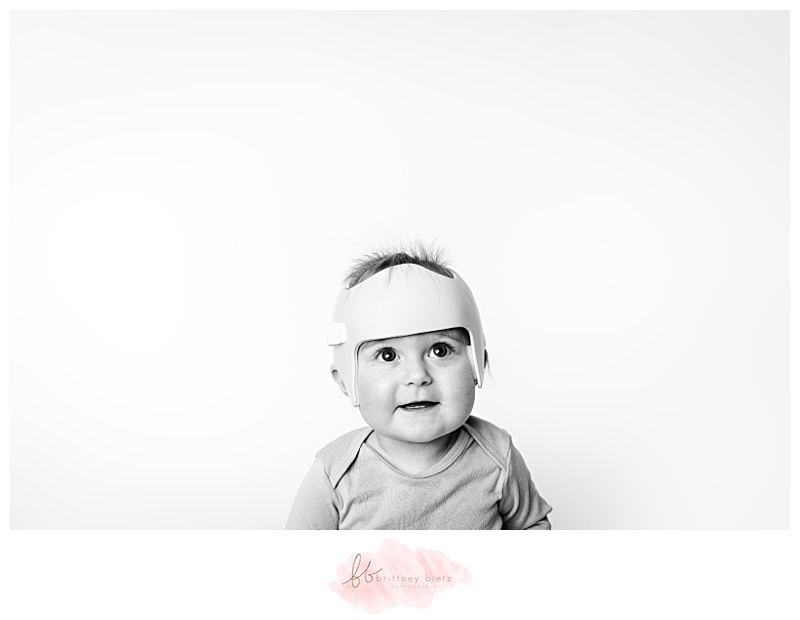 black and white portrait of a baby with head-shaping helmet looking up